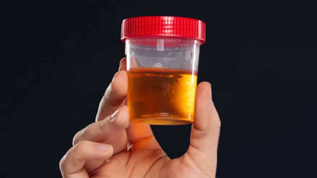 Health | మూత్రం నుండి వచ్చే దుర్వాసన ఎందుకు.. ఇది సమస్య సంకేతమా?