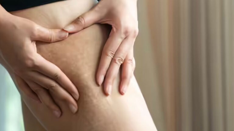 FAT | తొడల్లో పేరుకున్న కొవ్వును కరిగించడానికి సులభమైన వ్యాయామాలు .. డైట్ పాటిస్తే..