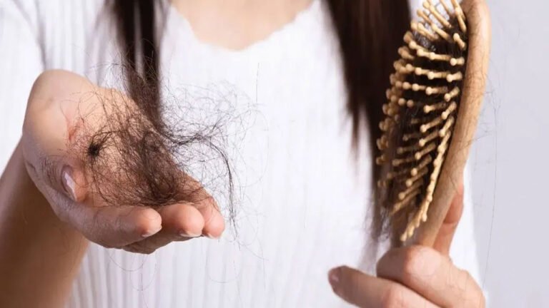 Hair | జుట్టు రాలడం సమస్యతో బాధపడుతున్నారా?.. ఈ చిట్కాలు పాటించండి..!