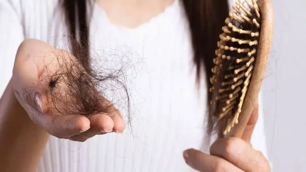 Hair | జుట్టు రాలడం సమస్యతో బాధపడుతున్నారా?.. ఈ చిట్కాలు పాటించండి..!
