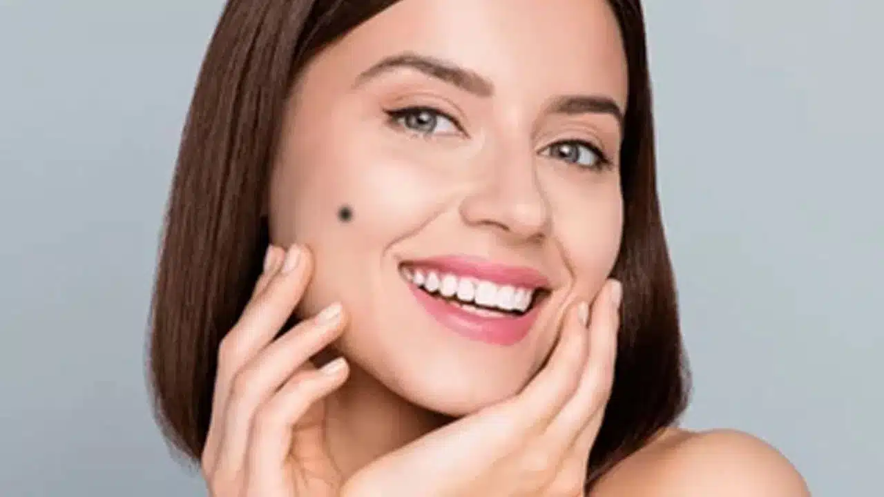 Mole | జ్యోతిషశాస్త్రం ప్రకారం కుడి బుగ్గపై పుట్టుమచ్చ ఉన్నవారి వ్యక్తిత్వ రహస్యాలు!