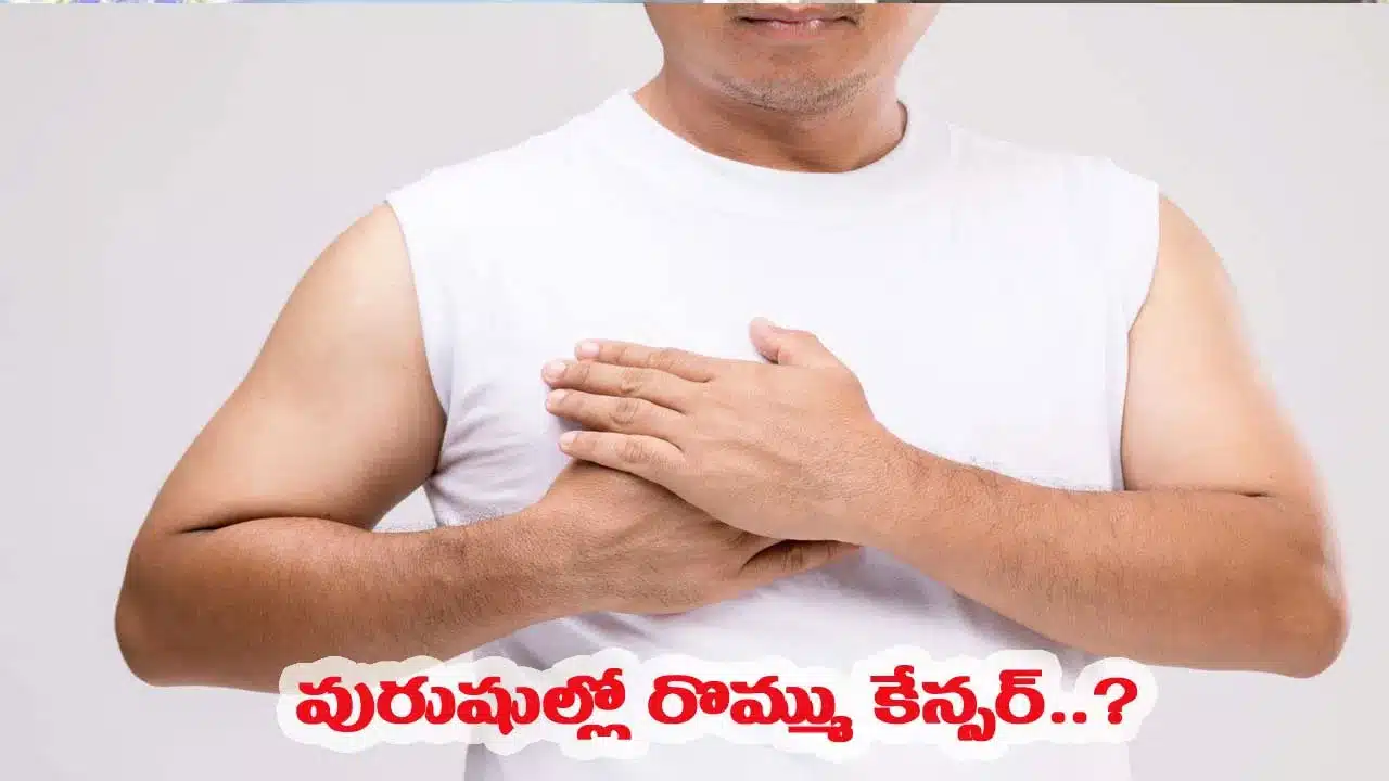 Cancer | గ్రౌండ్ జీరో సమీపంలో నివసిస్తున్న పురుషులలో రొమ్ము క్యాన్సర్ కేసులు ఆందోళనకరం!
