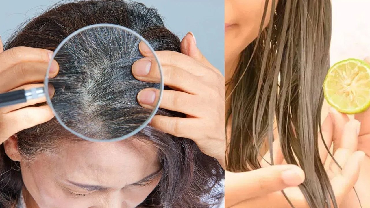 White Hair : జుట్టుకు నిమ్మరసం రాస్తే తెల్లబడుతుందా? ఇందులో నిజమెంత? నిపుణులు చెబుతున్న షాకింగ్ విషయాలు!